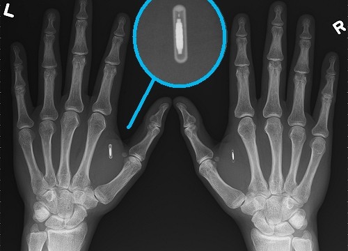 microchip