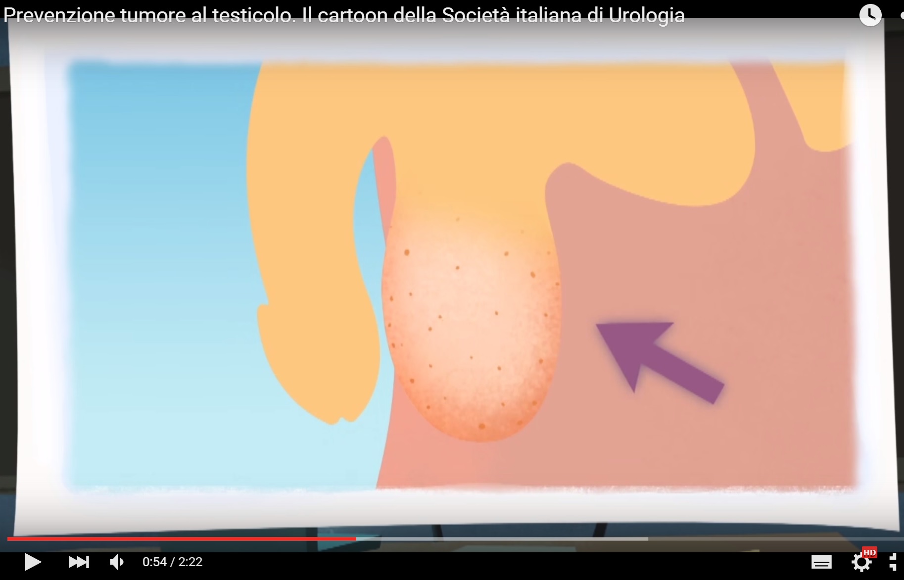 cancro testicoli